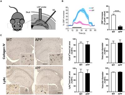 Impaired Hippocampal Neurovascular Coupling in a Mouse Model of Alzheimer’s Disease